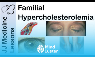 Familial Hypercholesterolemia Genetics Pathophysiology Symptoms and Treatment