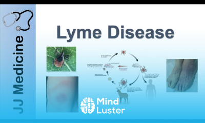 Lyme Disease Pathophysiology Signs and Treatment