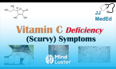 Vitamin C Deficiency Scurvy Symptoms ex bad teeth fatigue Why symptoms happen who gets them