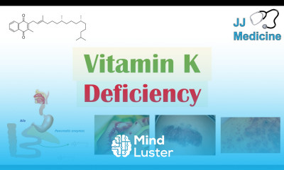 Vitamin K Deficiency Dietary Sources Causes Symptoms Diagnosis Treatment