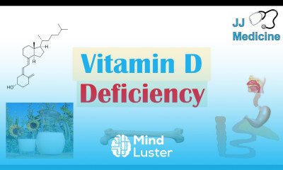 Vitamin D Deficiency Absorption Metabolism Purpose of Vit D Causes of Deficiency