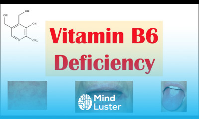 Vitamin B6 Pyridoxine Deficiency Dietary Sources Causes Signs Symptoms Diagnosis Treatment