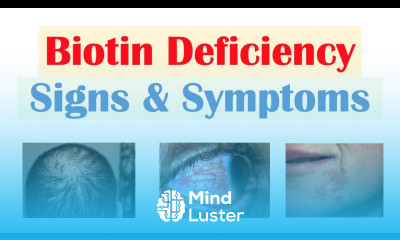 Biotin Vit B7 Deficiency Signs Symptoms Why They Occur
