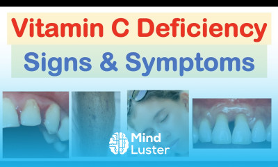 Vitamin C Deficiency Signs Symptoms Consequences Why They Occur