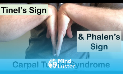 Carpal tunnel syndrome Tinel s sign and Phalen s sign Clinical Examination