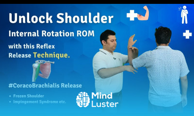 CORACOBRACHIALIS REFLEX RELEASE TREATMENT TO IMPROVE SHOULDER INTERNAL ROTATION RANGE IN SECONDS