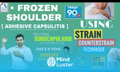 STRAIN COUNTERSTRAIN TREATMENT FOR FROZEN SHOULDER GAINING EXTERNAL ROTATION RANGE 