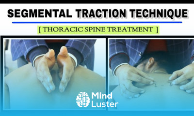 SEGMENTAL TRACTION TECHNIQUE IMPROVING MOBILITY TO REDUCE THORACIC FACET PAIN