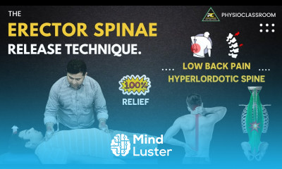 THE ERECTOR SPINAE RELEASE TECHNIQUE FOR LOW BACK PAIN