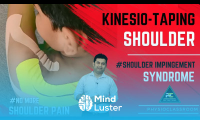 KINESIO TAPING FOR SHOULDER IMPINGEMENT SYNDROME ROTATOR CUFF TENDONITIS