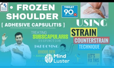 STRAIN COUNTERSTRAIN TREATMENT FOR FROZEN SHOULDER GAINING EXTERNAL ROTATION RANGE 