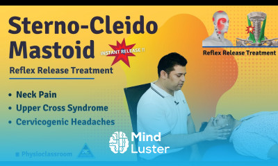 REFLEX RELEASE SCM TRIGGER POINTS IN SECONDS VERY HELPFUL IN NECK PAIN AND HEADACHE PATIENTS