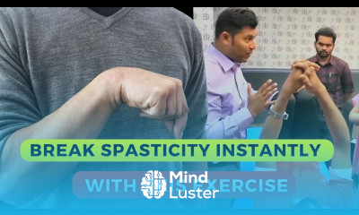 Simple Exercise to break Spasticity in Stroke Patients