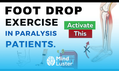 DESIGNING EXERCISE FOR FOOT DROP PATIENTS