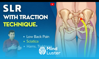 SLR WITH TRACTION TECHNIQUE GET RELIEF IN SCIATICA SYMPTOMS BACK LEG PAIN