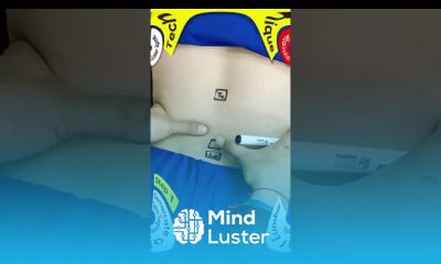 Lumbar Spine Mobilization Technique