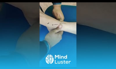 Bimalleolar Mobilization Technique for Ankle Pain Stiffness Edema