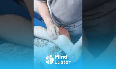 ACHIILES TENDONITIS PAIN TREATMENT