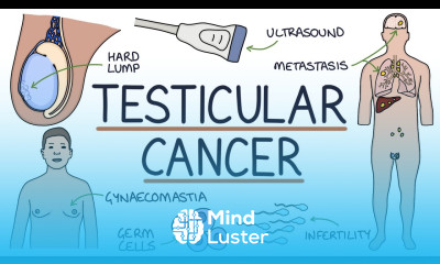 Understanding Testicular Cancer
