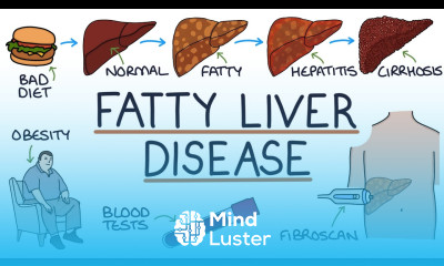 Understanding Non Alcoholic Fatty Liver Disease