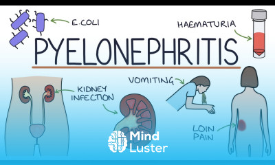Understanding Pyelonephritis Kidney Infections