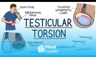 Understanding Testicular Torsion
