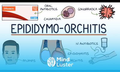 Understanding Epididymo orchitis