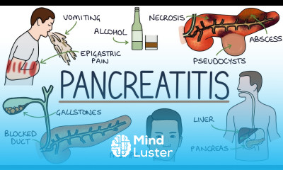Understanding Pancreatitis