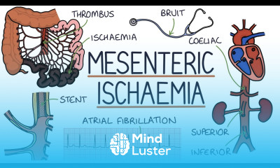 Understanding Mesenteric Ischaemia