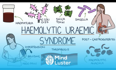 Haemolytic Uraemic Syndrome