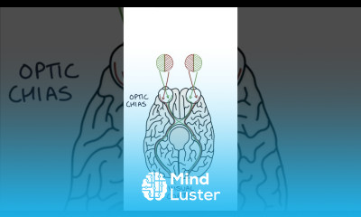 Bitemporal Hemianopia medicine clinicalexamination ophthalmology