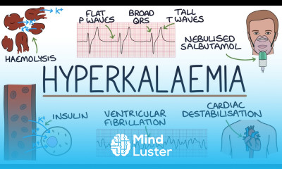 Understanding Hyperkalaemia High Potassium