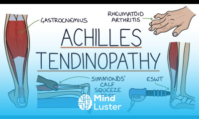 Understanding Achilles Tendinopathy Achilles Tendinitis