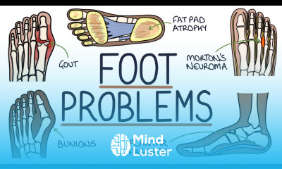 Common Foot Problems