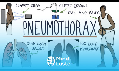 Pneumothorax