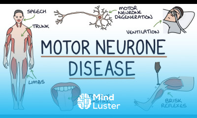 Understanding Motor Neurone Disease Amyotrophic Lateral Sclerosis