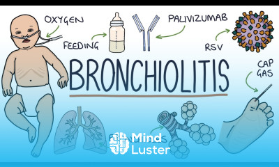 Understanding Bronchiolitis