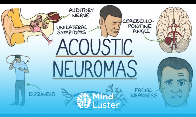 Understanding Acoustic Neuromas