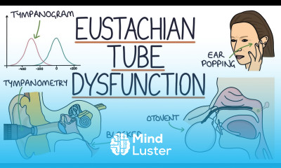 Understanding Eustachian Tube Dysfunction