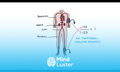 Understanding Ankle Brachial Pressure Index ABPI in Peripheral Vascular Disease