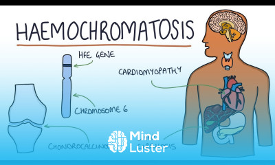 Understanding Haemochromatosis
