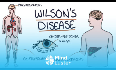 Understanding Wilson s Disease