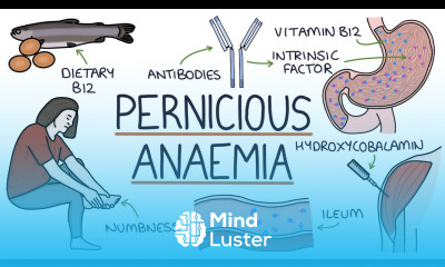 Understanding Pernicious Anaemia B12 Deficiency