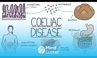 Understanding Coeliac Disease