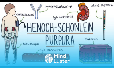 Henoch Schonlein Purpura Visual Explanation for Students