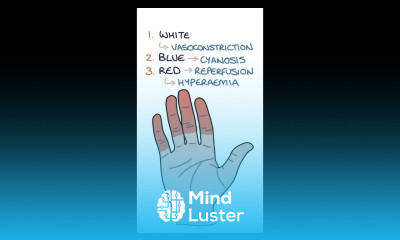 Raynaud s Disease medicine rheumatology