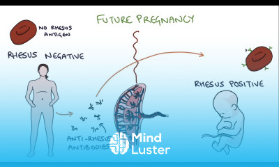 Understanding Rhesus Status and Anti D in Pregnancy
