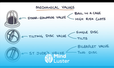 Prosthetic Heart Valves Visual Explanation for Students