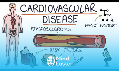 Understanding Cardiovascular Disease Visual Explanation for Students