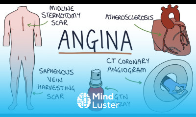Understanding Angina Visual Explanation for Students